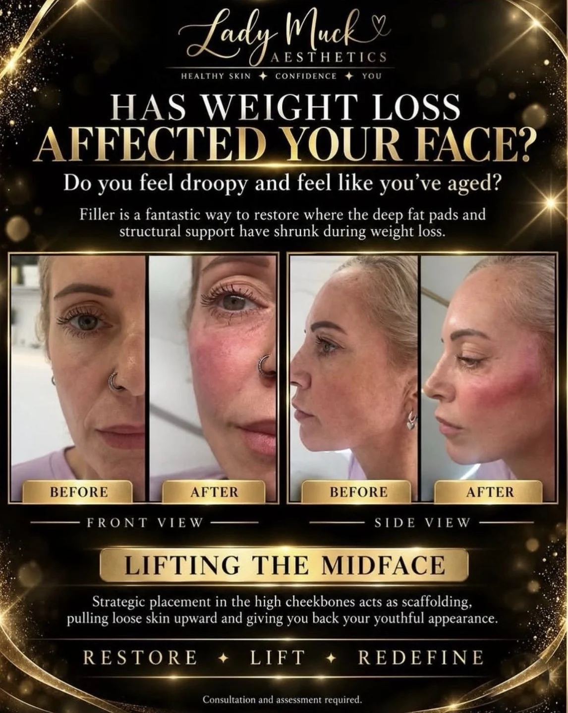 Weight loss face restoration before and after