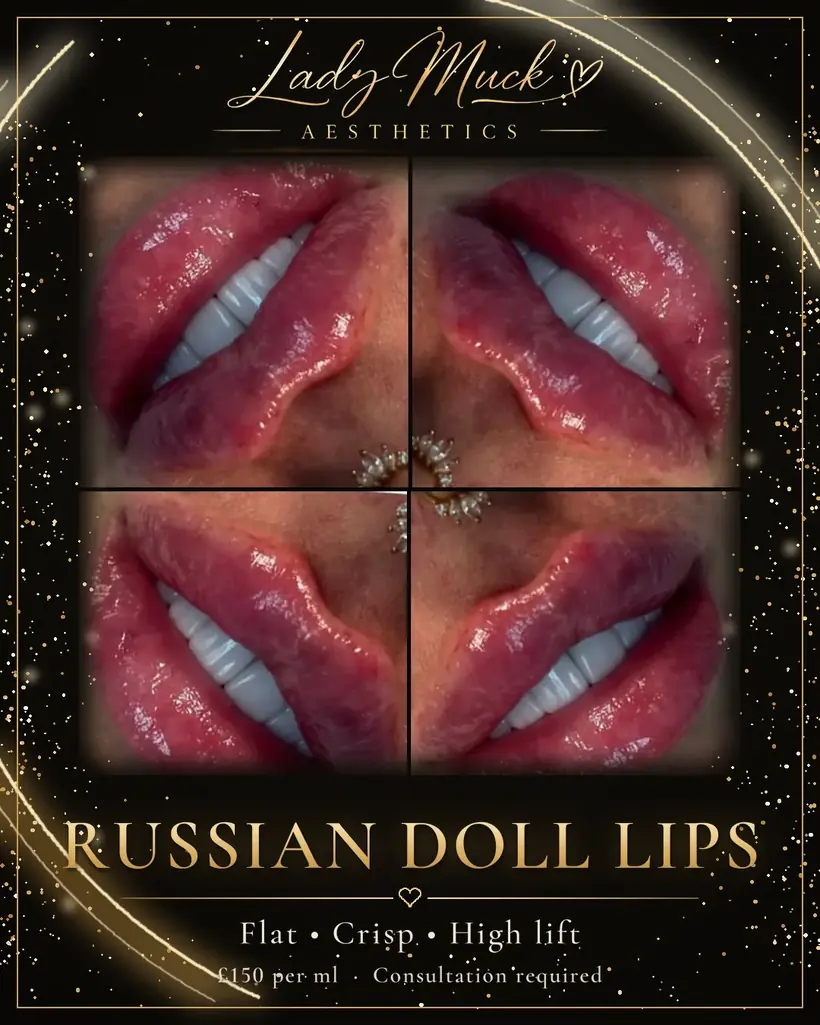 Russian doll lips before and after