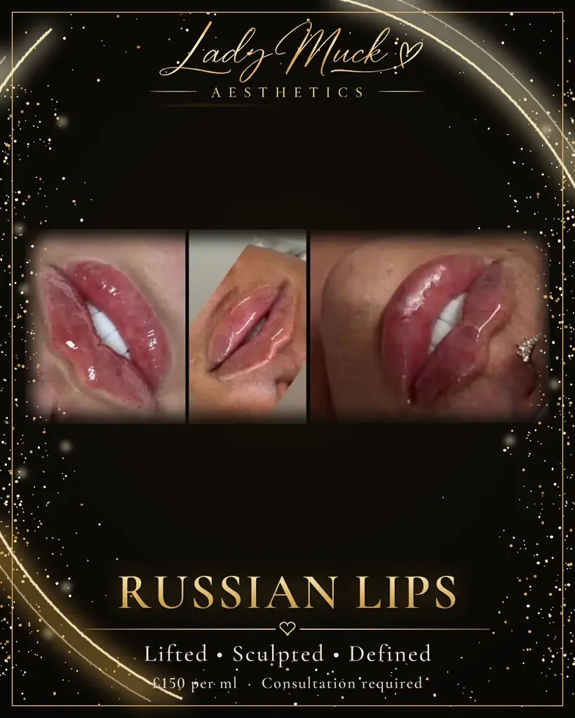 Russian lip technique before and after