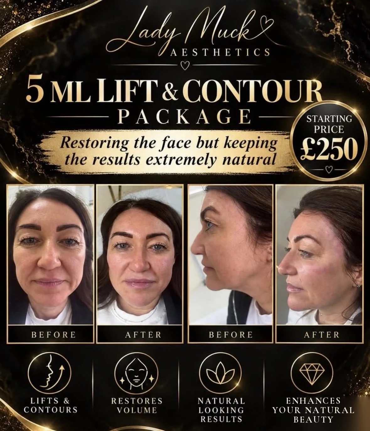 5 ml lift & contour package before and after