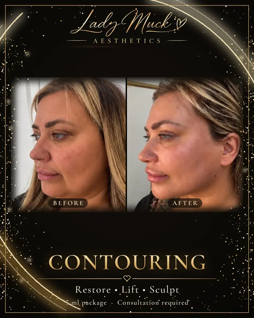 5 ml contour package before and after