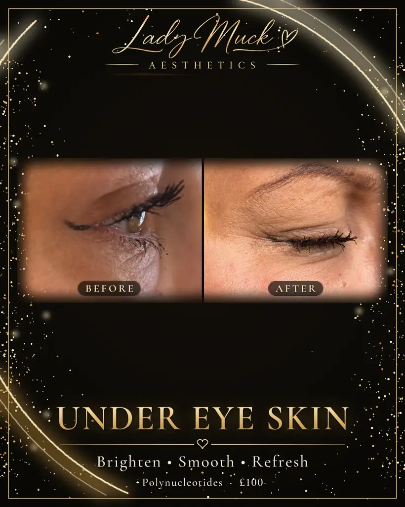 Polynucleotides: dark circles before and after